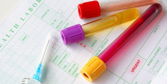 FDA Revises Guidance on Nitrosamine Impurities in Human Drugs