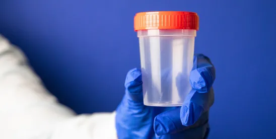 DOT alcohol drug random testing rates 2025