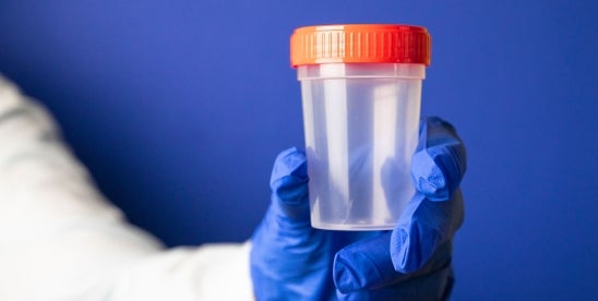 DOT alcohol drug random testing rates 2025