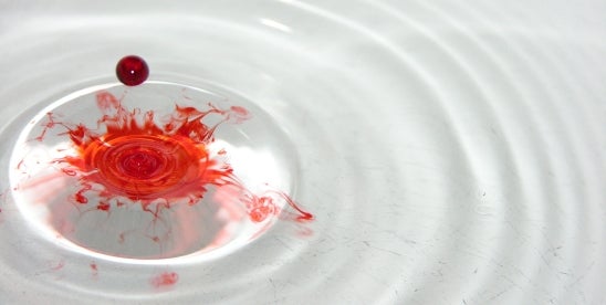 RFK Jr. pushes for synthetic dye elimination