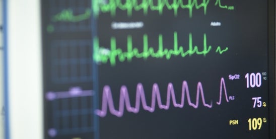 CA court denies tax exemption for cardiac monitors