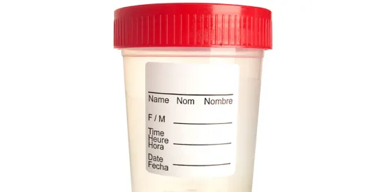 ADA compliance in drug testing & hiring decisions