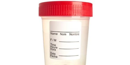 ADA compliance in drug testing & hiring decisions
