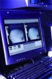 Cat scan