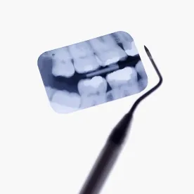 dental xray and tools