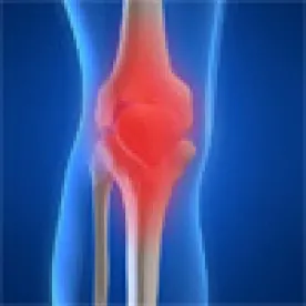 CMS Releases Final New Payment Model for Hip, Knee Replacements
