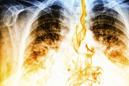 respiratory health, lung cancer, msha, miners, underground, diesel exhaust