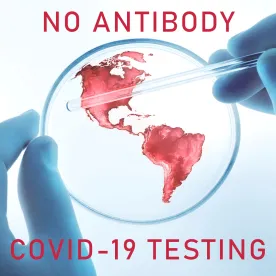 Employers may not COVID-19 Antibody test employees returning to work