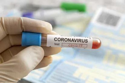 Coverage for Over-The-Counter COVID-19 Testing