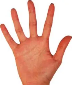 hand Consider When Negotiating In-License Agreements With Nonprofit Entities 
