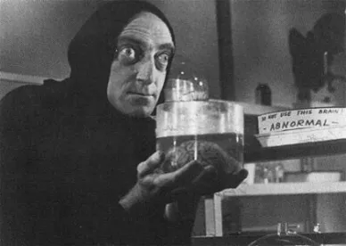 Igor Young Frankenstein