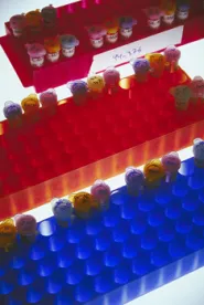 test tube, colors, research, drugs Abbvie, Androgel, Chicago, Bellwether case, multidistrict litigation, mass tort, product liability,