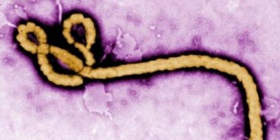 Ebola--How Should Employers Respond?  
