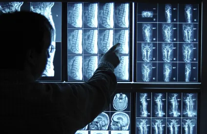 Doctor reading xrays