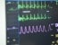 CA court denies tax exemption for cardiac monitors